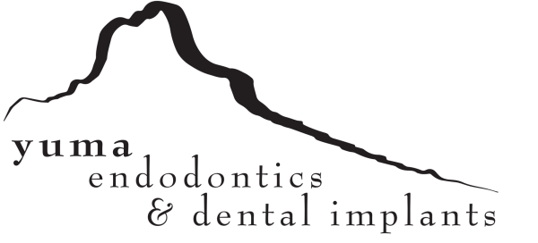 Yuma Endodontics and Dental Implants
